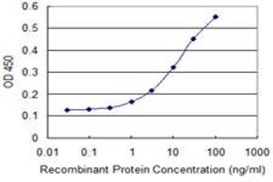 Detection limit for recombinant GST tagged AIP is 0. (AIP 抗体  (AA 156-249))