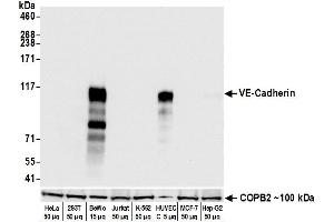 Western Blotting (WB) image for anti-Cadherin 5 (CDH5) (AA 48-599) antibody (ABIN7455190)