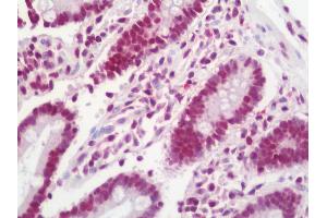 Anti-DHX8 antibody IHC staining of human small intestine. (DHX8 抗体  (AA 325-375))