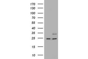 Image no. 1 for anti-RAB21, Member RAS Oncogene Family (RAB21) antibody (ABIN1500549) (RAB21 抗体)