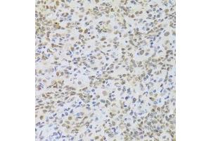 Immunohistochemistry of paraffin-embedded mouse lung using HMGB1 Antibody. (HMGB1 抗体  (AA 100-200))
