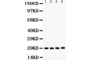 Western Blotting (WB) image for anti-Parkinson Protein 7 (PARK7) (AA 2-189) antibody (ABIN3043589) (PARK7/DJ1 抗体  (AA 2-189))