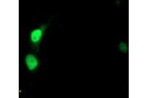 Image no. 3 for anti-Synovial Sarcoma, X Breakpoint 5 (SSX5) antibody (ABIN1501163) (SSX5 抗体)