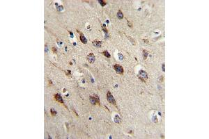 Formalin-fixed and paraffin-embedded human brain reacted with BDNF Antibody (C-term), which was peroxidase-conjugated to the secondary antibody, followed by DAB staining. (BDNF 抗体  (C-Term))