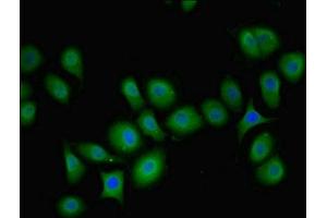 Immunofluorescent analysis of A549 cells using ABIN7163201 at dilution of 1:100 and Alexa Fluor 488-congugated AffiniPure Goat Anti-Rabbit IgG(H+L) (PIP4K2B 抗体  (AA 1-270))