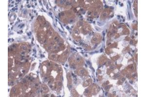 DAB staining on IHC-P; Samples: Human Stomach Tissue (Metaxin 1 抗体  (AA 175-387))