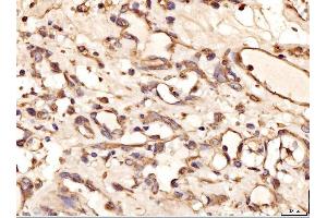IHC analysis of AASS using anti-AASS antibody (ABIN7601519). (AASS 抗体  (AA 37-865))