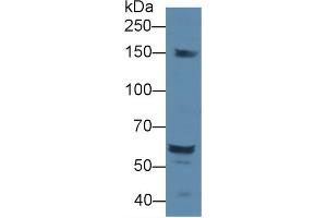 Western Blot; Sample: Rat Serum; Primary Ab: 1µg/ml Rabbit Anti-Rat DOK1 Antibody Second Ab: 0.