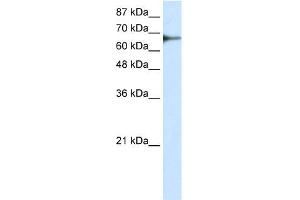 WB Suggested Anti-L3MBTL2 Antibody Titration: 0. (L3MBTL2 抗体  (C-Term))