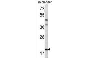 Western Blotting (WB) image for anti-BCL2-Associated Agonist of Cell Death (BAD) (BH3 Domain) antibody (ABIN2997223)