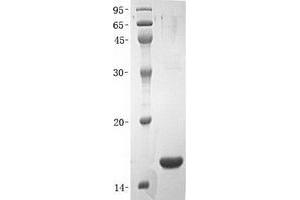 Validation with Western Blot (MAPT Protein (Transcript Variant 6) (His tag))