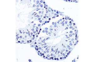 Immunohistochemistry of paraffin-embedded mouse testis using Phospho-SMC1-S957 Rabbit mAb (ABIN7270613) at dilution of 1:100 (40x lens). (SMC1A 抗体  (pSer957))