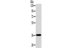 Western Blotting (WB) image for anti-PDZ and LIM Domain 1 (PDLIM1) antibody (ABIN2423956) (PDLIM1 抗体)