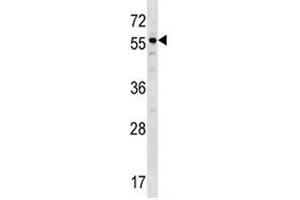 BMP3 antibody western blot analysis in ZR-75-1 lysate. (BMP3 抗体  (AA 318-347))