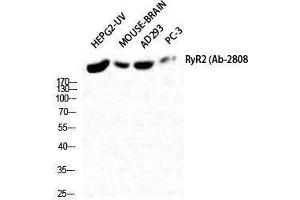 Western Blotting (WB) image for anti-Ryanodine Receptor 2 (Cardiac) (RYR2) (Tyr1018) antibody (ABIN3177320) (RYR2 抗体  (Tyr1018))