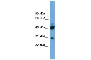 Western Blot showing PRR5 antibody used at a concentration of 1-2 ug/ml to detect its target protein. (PRR5 抗体  (N-Term))