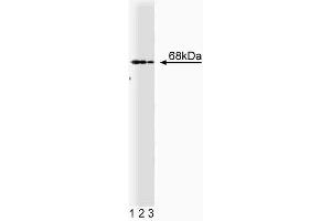Western blot analysis of PTP1C on Jurkat cell lysate. (SHP1 抗体  (AA 492-597))
