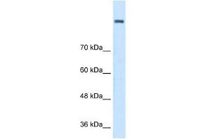 AOC2 antibody (retina specific) used at 1 ug/ml to detect target protein. (AOC2 抗体)
