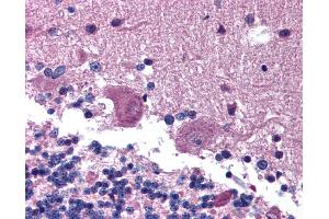Anti-KAL1 / Anosmin antibody IHC of human brain, cerebellum.