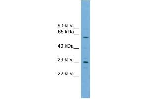 WB Suggested Anti-RPAIN Antibody Titration:  0. (RPAIN 抗体  (C-Term))