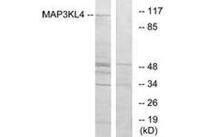 Western Blotting (WB) image for anti-Mitogen-Activated Protein Kinase Kinase Kinase MLK4 (KIAA1804) (AA 631-680) antibody (ABIN2889639) (MLK4 抗体  (AA 631-680))