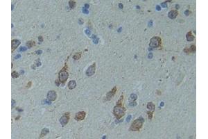 Detection of SMAD9 in Human Cerebrum Tissue using Polyclonal Antibody to SMAD family member 9 (SMAD9) (SMAD9 抗体  (AA 226-459))