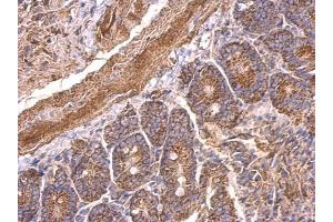 Immunohistochemistry (IHC) image for anti-Serotonin Receptor 1A (HTR1A) antibody (ABIN2855909)