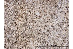 Image no. 1 for anti-Tankyrase, TRF1-Interacting Ankyrin-Related ADP-Ribose Polymerase (TNKS) (AA 1017-1125) antibody (ABIN599052) (TNKS 抗体  (AA 1017-1125))