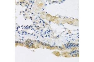 Immunohistochemistry (Paraffin-embedded Sections) (IHC (p)) image for anti-CAP-GLY Domain Containing Linker Protein 1 (CLIP1) (AA 1228-1427) antibody (ABIN6138726)