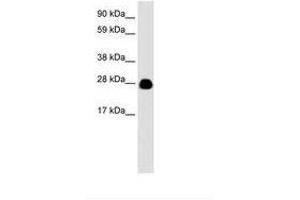 Image no. 3 for anti-14-3-3 eta (YWHAH) (AA 72-121) antibody (ABIN6735931) (14-3-3 eta 抗体  (AA 72-121))