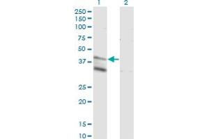 Western Blot analysis of LASS4 expression in transfected 293T cell line by LASS4 monoclonal antibody (M03), clone 7D5. (LASS4 抗体  (AA 57-139))
