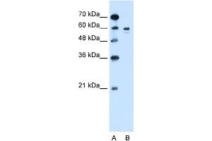 WB Suggested Anti-TYR Antibody Titration:  1. (TYR 抗体  (Middle Region))