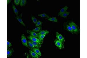 Immunofluorescence (IF) image for anti-Vesicular, Overexpressed in Cancer, Prosurvival Protein 1 (VOPP1) (AA 23-172) antibody (ABIN7175503)