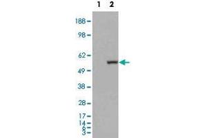 HEK293 overexpressing ALDH1A1 and probed with ALDH1A1 polyclonal antibody  (mock transfection in first lane), tested by Origene. (ALDH1A1 抗体  (C-Term))