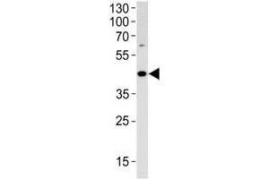ADA antibody western blot analysis in HL-60 lysate (ADA 抗体  (AA 287-314))