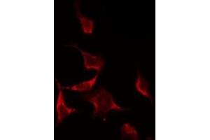 ABIN6268845 staining NIH-3T3 by IF/ICC. (NRF1 抗体  (Internal Region))