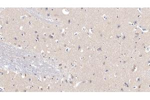 Immunohistochemistry (IHC) image for anti-Superoxide Dismutase 1, Soluble (SOD1) (AA 2-154) antibody (ABIN7429208)