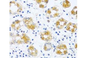 Immunohistochemistry of paraffin-embedded Human stomach using BRK1 Polyclonal Antibody at dilution of 1:100 (40x lens). (BRK1 抗体)