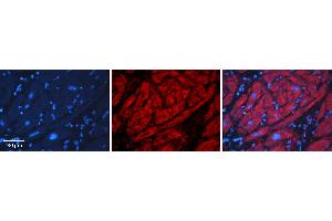 Rabbit Anti-ADH1B Antibody   Formalin Fixed Paraffin Embedded Tissue: Human heart Tissue Observed Staining: Cytoplasmic Primary Antibody Concentration: N/A Other Working Concentrations: 1:600 Secondary Antibody: Donkey anti-Rabbit-Cy3 Secondary Antibody Concentration: 1:200 Magnification: 20X Exposure Time: 0. (ADH1B 抗体  (N-Term))