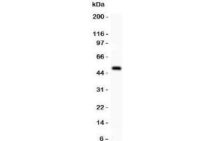 Western blot testing of alpha Catenin antibody and recombinant human protein (0. (CTNNA1 抗体  (AA 143-292))