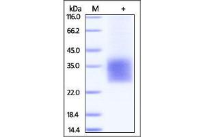 SDS-PAGE (SDS) image for CD3d Molecule, delta (CD3-TCR Complex) (CD3D) (AA 22-105) protein (His tag) (ABIN2180770)