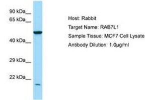 Image no. 1 for anti-RAB7, Member RAS Oncogene Family-Like 1 (RAB7L1) (N-Term) antibody (ABIN6750021) (RAB7L1 抗体  (N-Term))