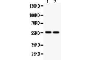 Anti- ALDH2  Picoband antibody, Western blottingAll lanes: Anti ALDH2  at 0. (ALDH2 抗体  (N-Term))
