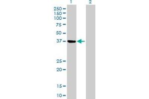 Western Blot analysis of PSAT1 expression in transfected 293T cell line by PSAT1 MaxPab polyclonal antibody. (PSAT1 抗体  (AA 1-370))