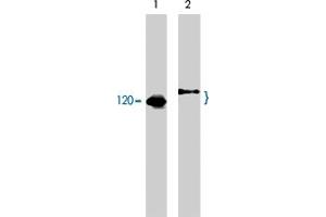 Western blot analysis of human Jurkat cells untreated (lane 1) or treated with pervanadate (1 mM) for 30 minutes (lane 2). (CBL 抗体  (C-Term))