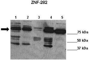 Lanes : Lane 1: 20ug Bewo cells Lane 2: 20ug HEK cells Lane 3: 20ug JEG3 cells Lane 4: 20ug PC3 cells Lane 5: 20ug SHEP cells  Primary Antibody Dilution :  1:1000   Secondary Antibody : Anti-rabbit-HRP  Secondary Antibody Dilution :  1:7500  Gene Name : ZNF282  Submitted by : Lisa Stubbs, University of Illinois (ZNF282 抗体  (C-Term))