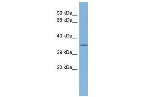TTC35 antibody used at 1 ug/ml to detect target protein. (TTC35 抗体  (Middle Region))