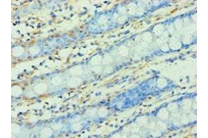 Immunohistochemistry of paraffin-embedded human colon tissue using ABIN7166295 at dilution of 1:100