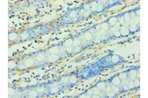 Immunohistochemistry of paraffin-embedded human colon tissue using ABIN7166295 at dilution of 1:100 (WNT2 抗体  (AA 26-360))