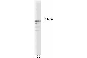Western blot analysis of Beclin on a Jurkat lysate. (Beclin 1 抗体  (AA 171-291))